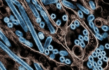 Une image de particules du virus de la grippe aviaire A H5N1 (en bleu), obtenue le 22 novembre 2024 auprès des Centres américains de prévention et de lutte contre les maladies et de l'Institut national des allergies et des maladies infectieuses ( National Institute of Allergy and Infectious Diseases / HANDOUT )