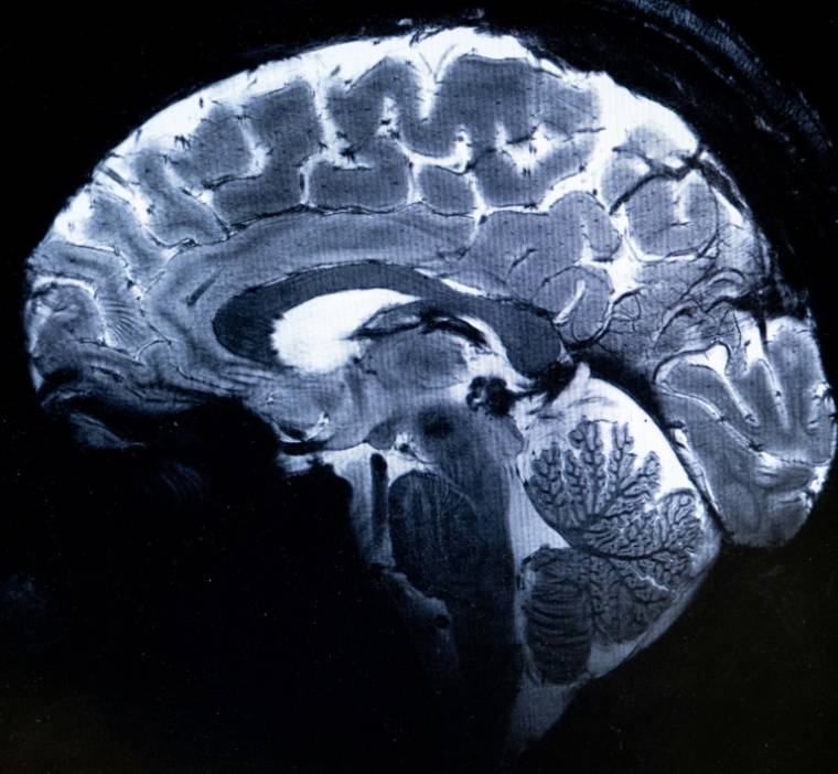 Cette image réalisée avec l'IRM Iseult montre un cerveau lors d'une simulation d'examen d'imagerie par résonance magnétique (IRM), au centre du Commissariat à l'énergie atomique et aux énergies alternatives (CEA) de Paris-Saclay à Gif-sur-Yvette, le 22 mars 2024 ( AFP / ALAIN JOCARD )