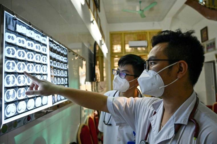 Le médecin vietnamien Truong Duc Thai (d) et un collègue en train de vérifier les radiographies d'un patient atteint d'une tuberculose résistante aux médicaments à l'hôpital national du poumon à Hanoï, le 2 avril 2024 ( AFP / Nhac NGUYEN )