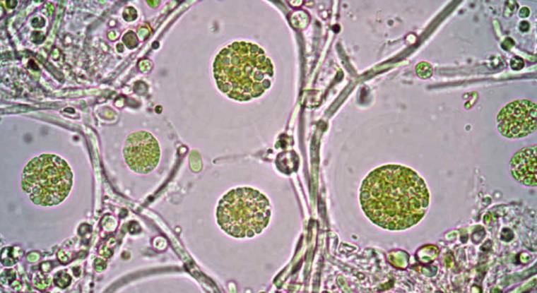 Fermentalg produit des acides gras oméga-3 grâce à des microalgues. (© cc Universidad EAFIT)