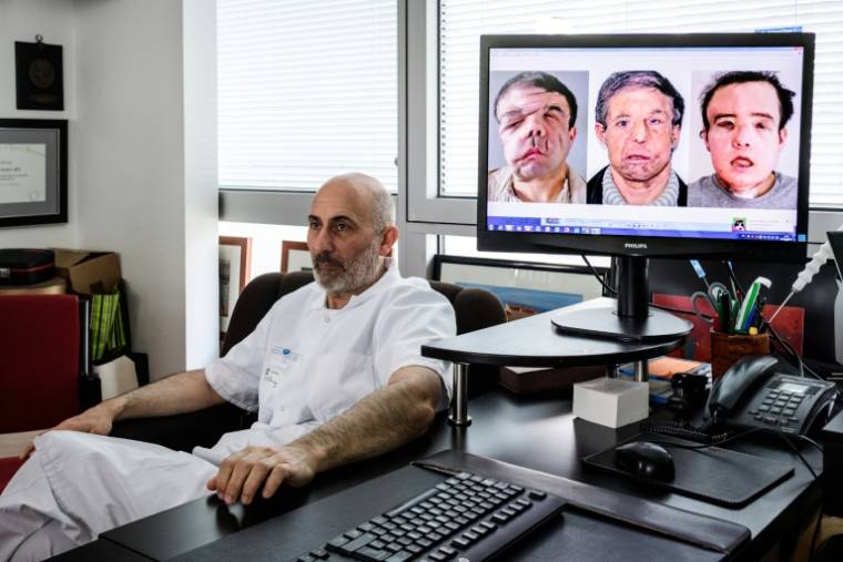le Pr Laurent Lantieri, spécialiste de la greffe de main et de visage, à côté d'un écran montrant les différentes étapes de l'opération de son patient Jérôme Hamon, à l'hôpital européen Georges-Pompidou, le 13 avril 2018 à Paris ( AFP / Philippe LOPEZ )