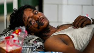Un survivant de la pire catastrophe ferroviaire en Inde depuis 20 ans, près de Balasore (est), dans un hôpital public, le 3 juin 2023 ( AFP / Punit PARANJPE )