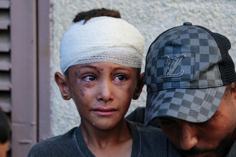 Un enfant blessé pleure dans la cour de l'hôpital des Martyrs d'Al-Aqsa à Deir el-Balah, dans le centre de la bande de Gaza, à la suite d'une frappe israélienne nocturne, le 10 août 2024 ( AFP / Eyad BABA )