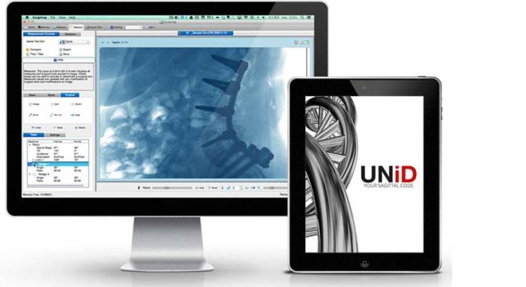 Unid est une plateforme logicielle capable de produire, à partir des radiographies et des scanners des patients, des tiges dont la courbure est parfaitement adaptée à la morphologie des patients. (© Medicrea)
