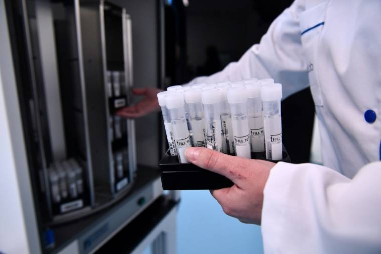 Des échantillons de salive dans le laboratoire d'analyse de l'endométriose Ziwig à Tercis-les-Bains, dans le département des Landes, le 25 mars 2024 ( AFP / GAIZKA IROZ )