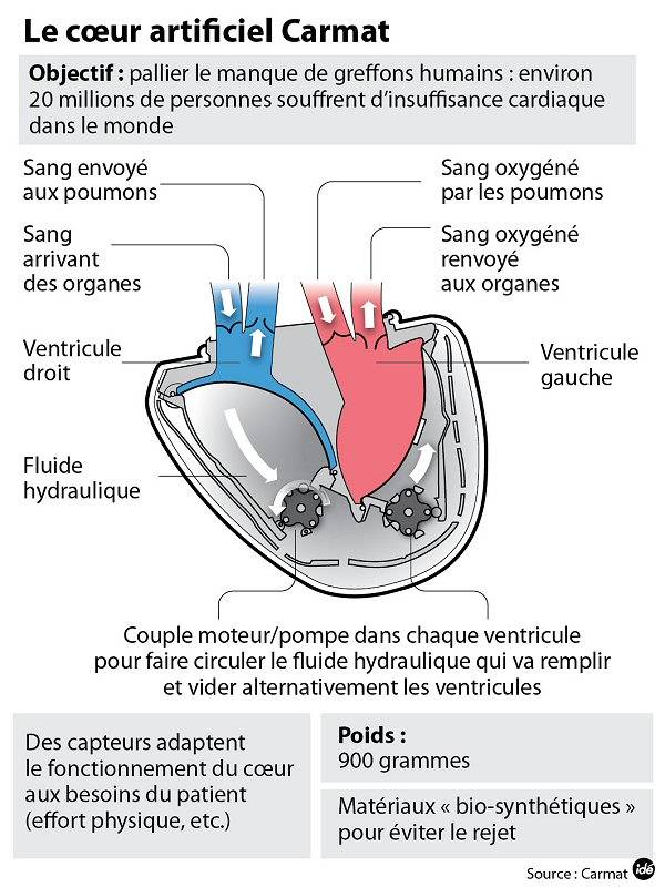 Le coeur artificiel Carmat pèse 900 grammes.