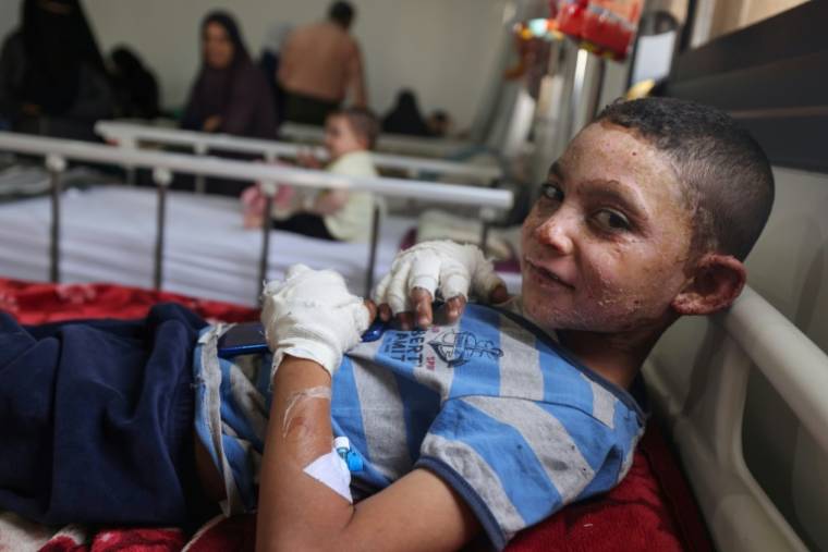 Un jeune Palestinien blessé est soigné par l'ONG Médecins sans frontières (MSF) pour des brûlures après des bombardements israéliens, à l'hôpital de campagne indonésien de Rafah, dans le sud de la bande de Gaza, le 24 avril 2024 ( AFP / MOHAMMED ABED )