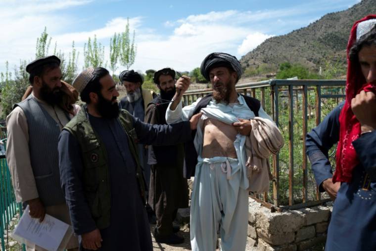 Malak Zera Gul (2e d), membre de la tribu des Balkhel dont le fils a été tué en 2017, montre ses blessures par balle près de la tombe de son fils dans la zone des Balkhel du district de Janikhel, dans la province de Paktia, le 22 avril 2024 en Afghanistan ( AFP / Wakil KOHSAR )