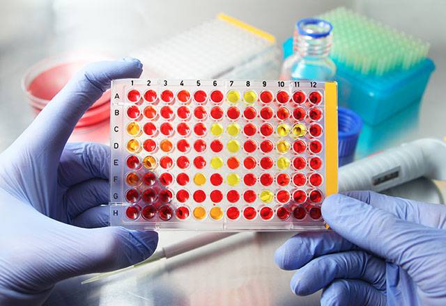 La biotech a signé un partenariat stratégique avec l'Institut Pasteur dans le domaine des thérapies géniques ciblant les pertes de l'audition. (crédit : Adobe Stock)